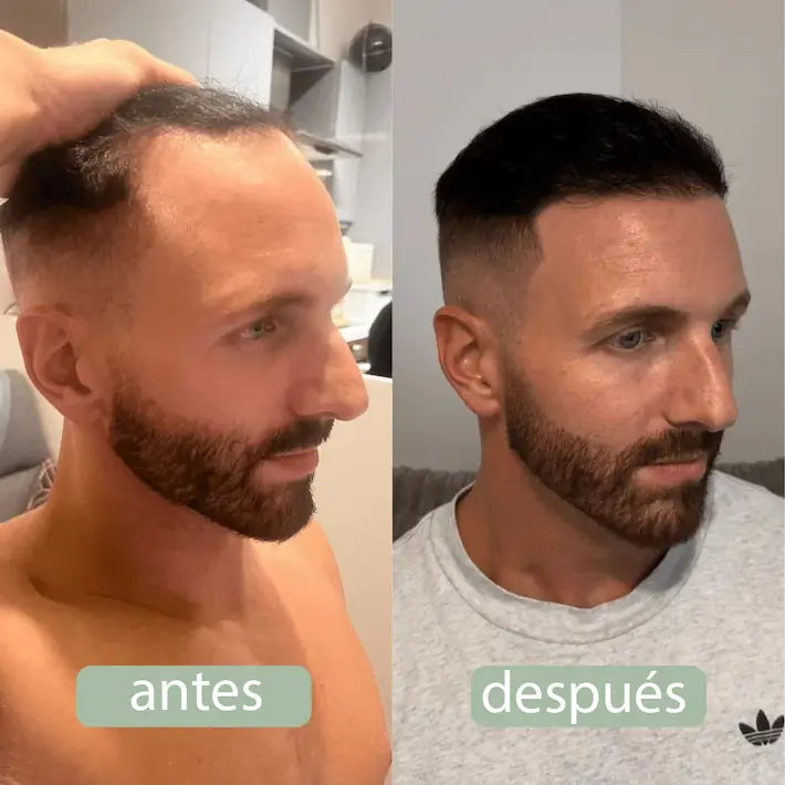 BodyWise - Suero para Crecimiento Capilar