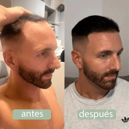 BodyWise - Suero para Crecimiento Capilar